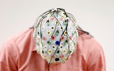 Nghiên cứu mới: kích thích điện giúp tăng khả năng làm toán