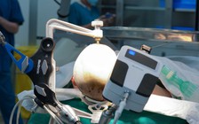 Công nghệ robot định vị Autoguide điều trị động kinh kháng trị