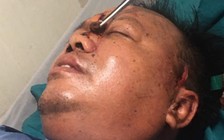 Thuyền trưởng bị nhiều người trên các tàu cá vây đánh, chém bị thương