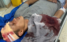 Nhóm côn đồ xông vào quán karaoke chém trọng thương chủ quán và nhiều người