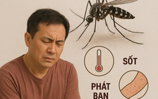 Bệnh chikungunya: Những thông tin có thể bạn chưa biết