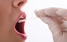 Phát hiện sớm nguy cơ mắc bệnh tim ở trẻ bằng cách lấy dịch vùng má?