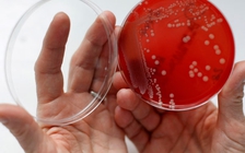 Gia tăng vi khuẩn kháng kháng sinh