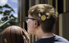 Vì sao máy trợ thính gắn ngoài có giá hàng trăm triệu đồng?