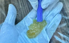 TP.HCM: Sặc bánh trôi nước khiến cụ ông hôn mê, ngưng tim