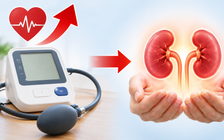 Bác sĩ 24/7: Huyết áp cao thường xuyên có dẫn đến suy thận không?