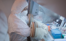 Nga cập nhật thông tin nghi vấn dịch hạch