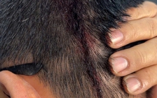 TP.HCM: Điều tra vụ người đàn ông bị hàng xóm tấn công gây thương tích