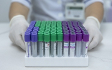 Bệnh án điện tử giảm xét nghiệm trùng lặp