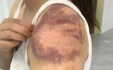 Tạm giữ hình sự đối tượng trói, đánh con ruột, hành hạ vợ mang thai