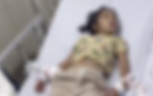 Sau 3 tháng bị chó cắn, bé gái 6 tuổi tử vong