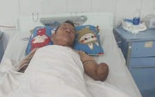 Cụ ông cụt 2 tay kẹp rắn hổ mang đem về nhà: Nhiều người tìm đến giúp đỡ