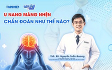 Bác sĩ ơi: U nang màng nhện cần được chẩn đoán như thế nào?
