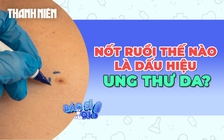 Cảnh báo những nốt ruồi bất thường là dấu hiệu của ung thư da