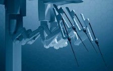 Bác sĩ điều khiển robot phẫu thuật ung thư từ khoảng cách 2.400 km