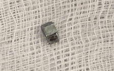 Bé trai 5 tuổi ho, đau họng, đi khám phát hiện nuốt 7 viên nam châm