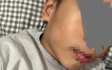 TP.HCM: Trường mầm non Hoa Lư đình chỉ 2 cô có hành vi không chuẩn mực với trẻ