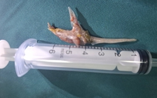 Nuốt đinh, hóc xương, rơi răng giả: Những ca cấp cứu khiến bác sĩ toát mồ hôi