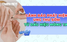Phát hiện ung thư sớm từ dấu hiệu trên móng tay