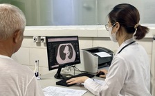 5 trường hợp cần tầm soát ung thư phổi