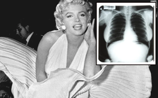 Ảnh X-quang của Marilyn Monroe gây phẫn nộ khi bị đấu giá