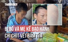 Toàn cảnh vụ bé trai nghi bị bố và mẹ kế bạo hành: Đã nhập viện với chi chít vết bầm tím