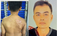 Phú Thọ: Bắt giam người cha đánh đập con trai dã man