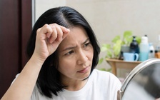 Nhổ tóc bạc có khiến tóc bạc nhiều hơn? Chuyên gia giải đáp