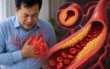 4 xét nghiệm nam giới từ 40 tuổi nên thực hiện định kỳ