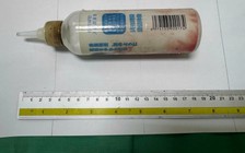 Đưa chai nhựa vào hậu môn, nam thanh niên phải nhập viện phẫu thuật lấy dị vật