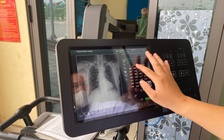 Hà Nội khám sàng lọc miễn phí 12 bệnh mạn tính, ác tính