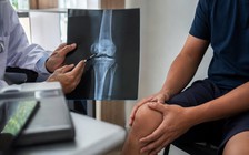 Các triệu chứng ban đầu của ung thư xương