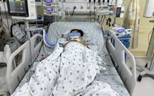 Ăn chuột đồng nhiều ngày, 3 chị em ngộ độc thuốc diệt chuột