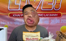 Từ người 'mặt quỷ' thành KOC truyền cảm hứng