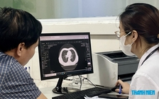 Những dấu hiệu nên khám, tầm soát ung thư phổi ở người không hút thuốc