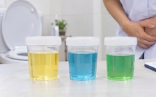 Nước tiểu xanh dương, xanh lá: Khi nào cần đi khám?