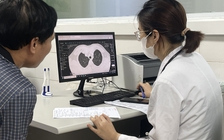 5 nhóm bệnh hưởng 100% bảo hiểm y tế tại Bệnh viện Bạch Mai Ninh Bình