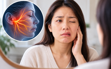 Sáng ngủ dậy méo miệng có phải do 'trúng gió'? Bác sĩ giải đáp