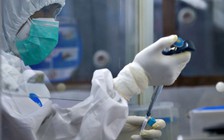 Các nước áp dụng xét nghiệm PCR như thế nào?