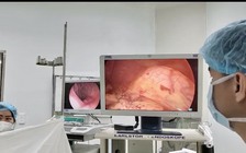 Phẫu thuật nội soi cứu người đàn ông bị ung thư thực quản