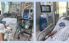 Nhiều trẻ sốc sốt xuất huyết nặng, biến chứng suy hô hấp, tổn thương đa cơ quan