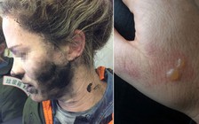 Pin tai nghe phát nổ trên máy bay đến Úc