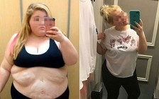 Cô gái trẻ giảm 71 kg trong 4 năm từng tìm đến cái chết