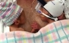 Trẻ song sinh tay trong tay