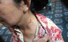 Bà chủ khéo léo thoát khỏi lưỡi dao kề cổ của tên cướp