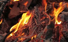 Những cách sơ cứu bỏng lửa hiệu quả