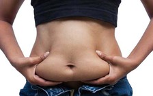Gần mãn kinh, giảm ngay mỡ bụng để ngừa ung thư