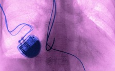 Tin tặc có thể tấn công vào những thiết bị y tế để gây hại cho bệnh nhân