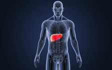 5 loại thực phẩm giúp đối phó bệnh gan nhiễm mỡ