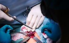 Báo động một loại vi khuẩn sống trên da người có thể gây tử vong